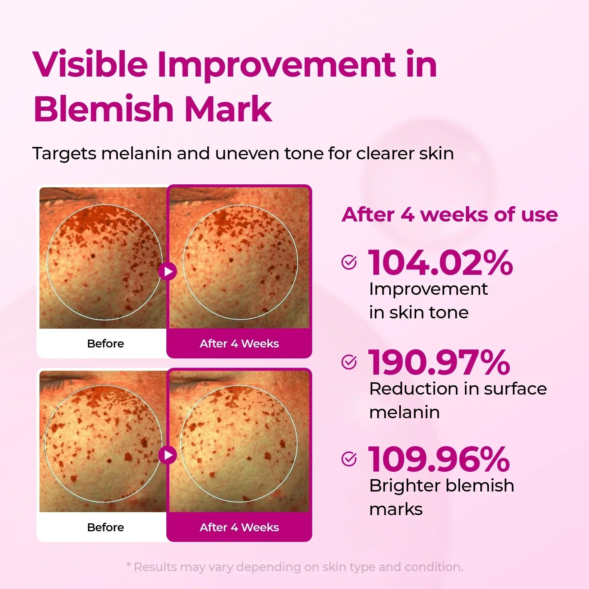 Picotonic Shot 4-week test results on blemish marks and skin tone
