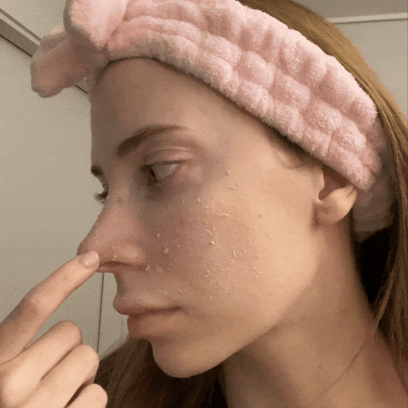 Using the Peel Shot ampoule on the face