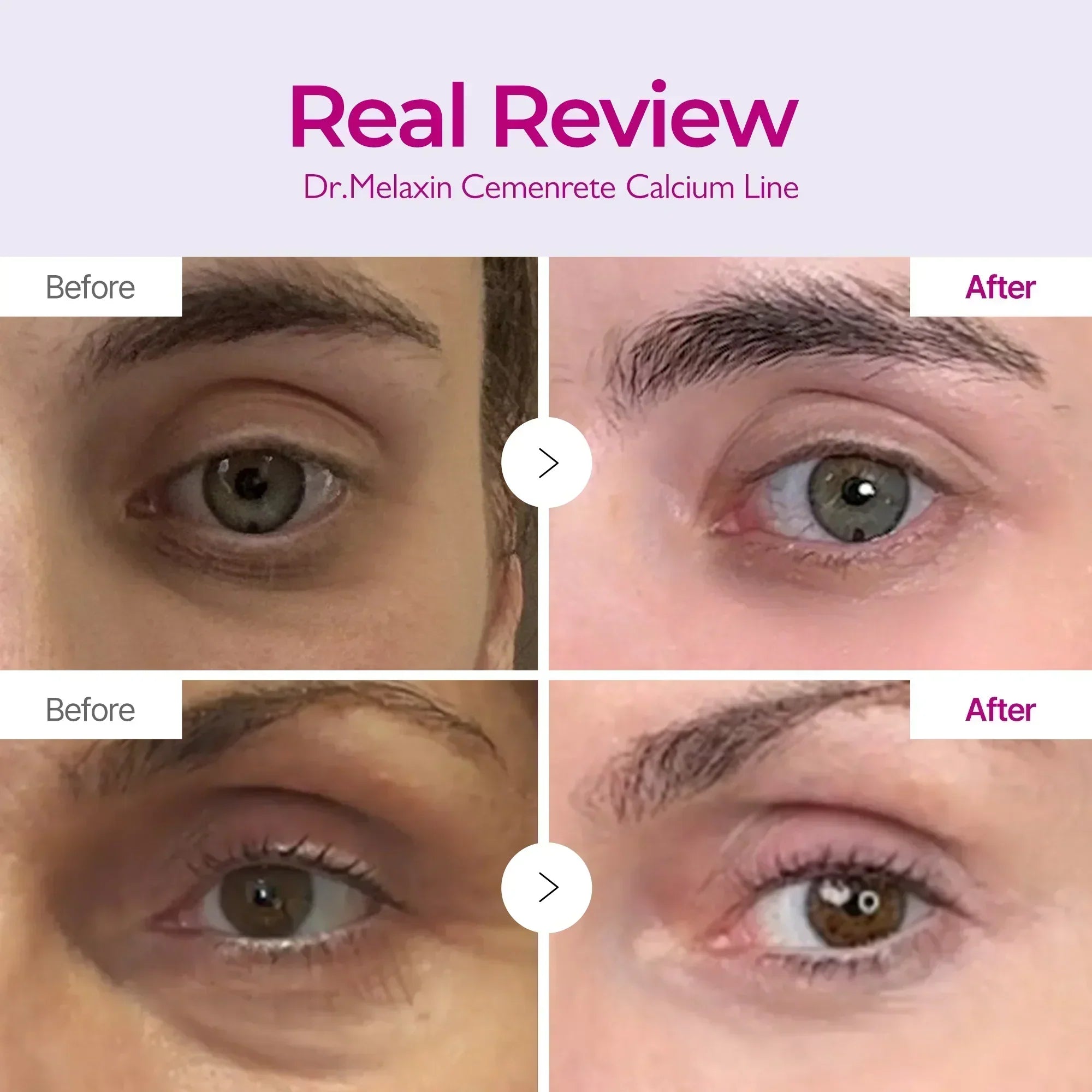 Cemenrete Calcium line real review before and after