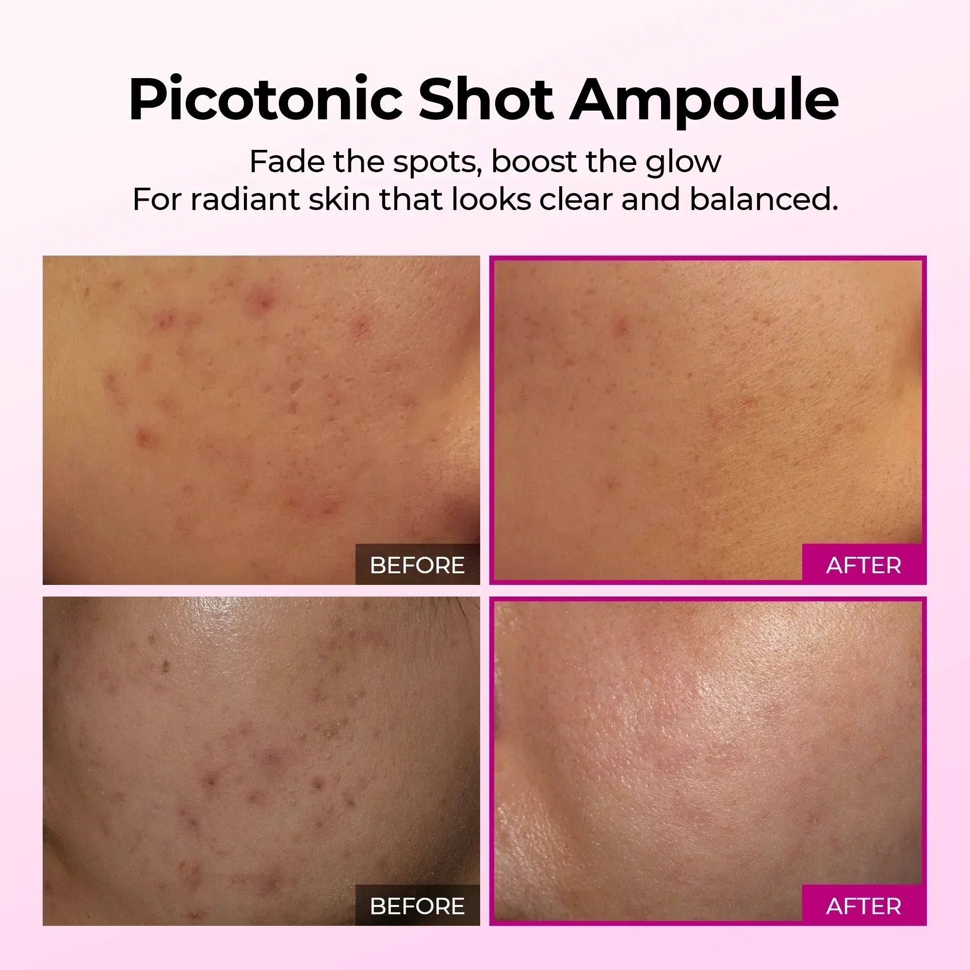 Picotonic Shot Ampoule before and after — fading dark spots