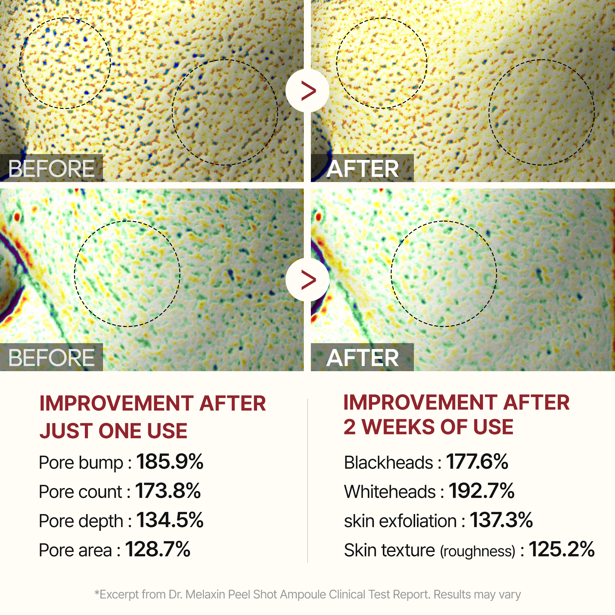 Black Rice Ampoule pore and blackhead results before and after