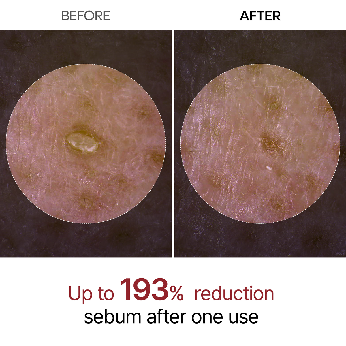 Black Rice Ampoule — up to 193% sebum reduction after one use