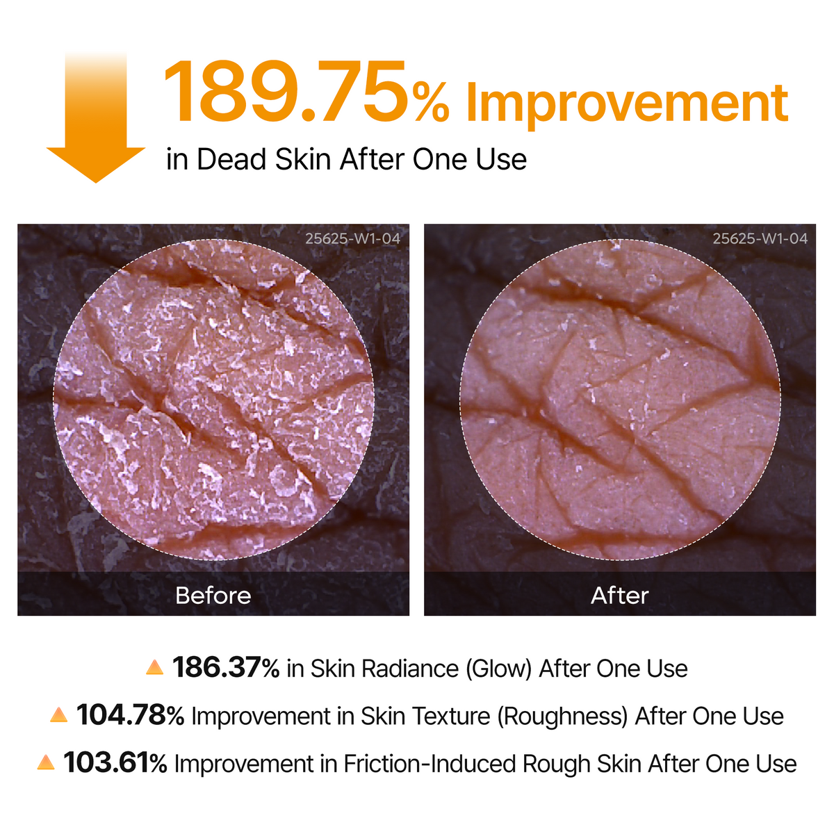 Kojic Acid Turmeric body spray — 189.75% improvement in dead skin after one use