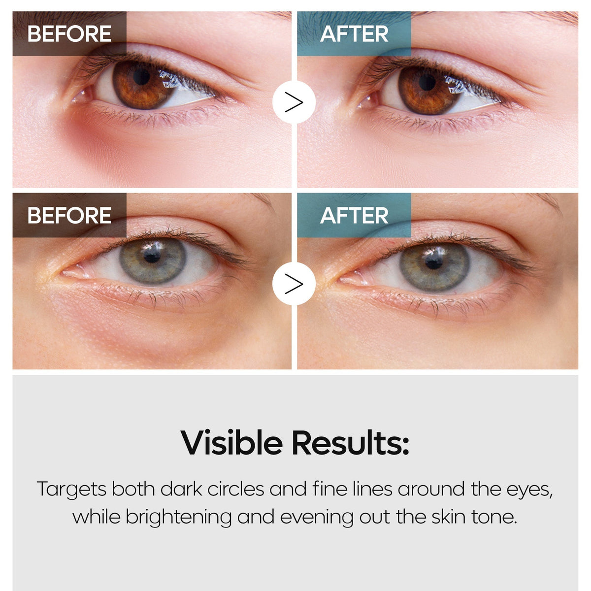 TX Eye Care Trio